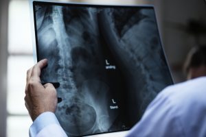 Больше миллиона ученых проанализировали столичные рентгенологи с помощью ИИ. Фото: pixabay.com
