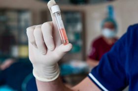 Ученые НИИ Николая Склифосовского запатентовали метод ускоренного заживления ран и переломов. Фото: Telegram-канал НИИ имени Николая Склифосовского